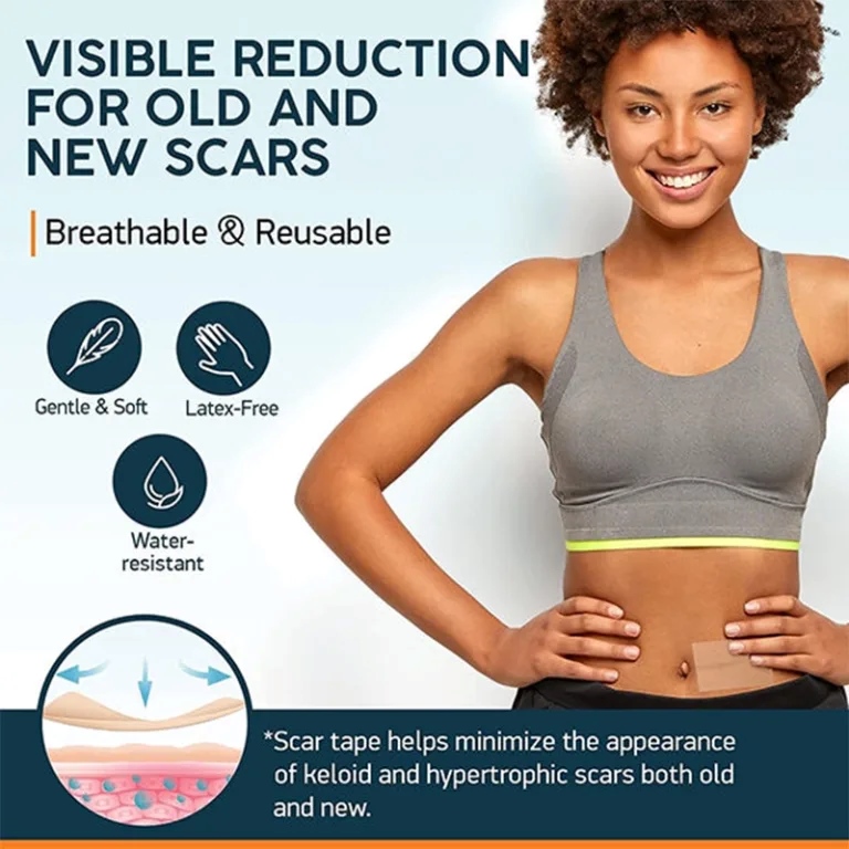 silicone scar treatment tape